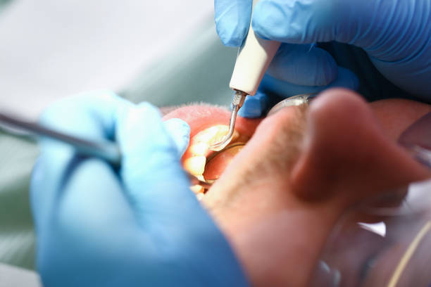 Best Same-Day Emergency Dental Services in Wolcottville, IN
