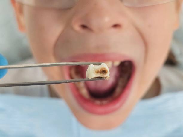 Best Weekend Emergency Dentist in Wolcottville, IN