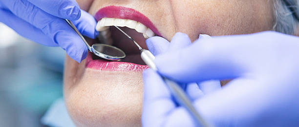 Best Emergency Dental Care for Broken or Chipped Teeth in Wolcottville, IN